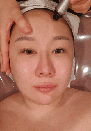  노원피부관리 월짱몸짱노원점 - 아쿠아필후기