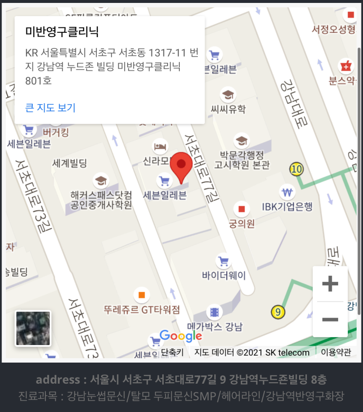  [캐슬준의 찐리뷰] 강남 SMP 두피 문신 잘하는 곳! 미반영구클리닉 헤어라인 문신