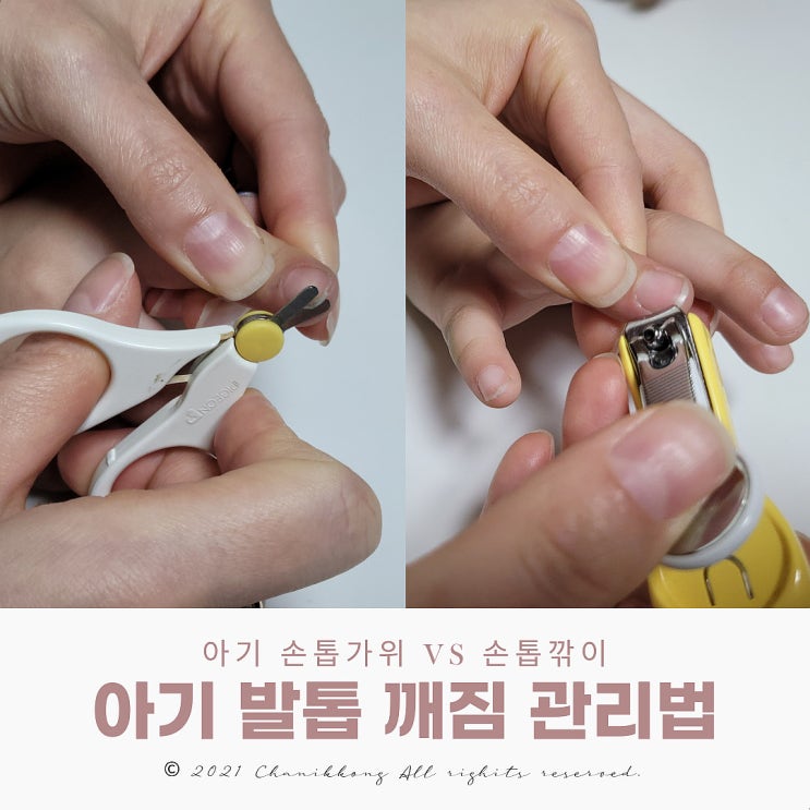  아기 발톱 깨짐 관리법 손톱깎이 vs 손톱가위 비교