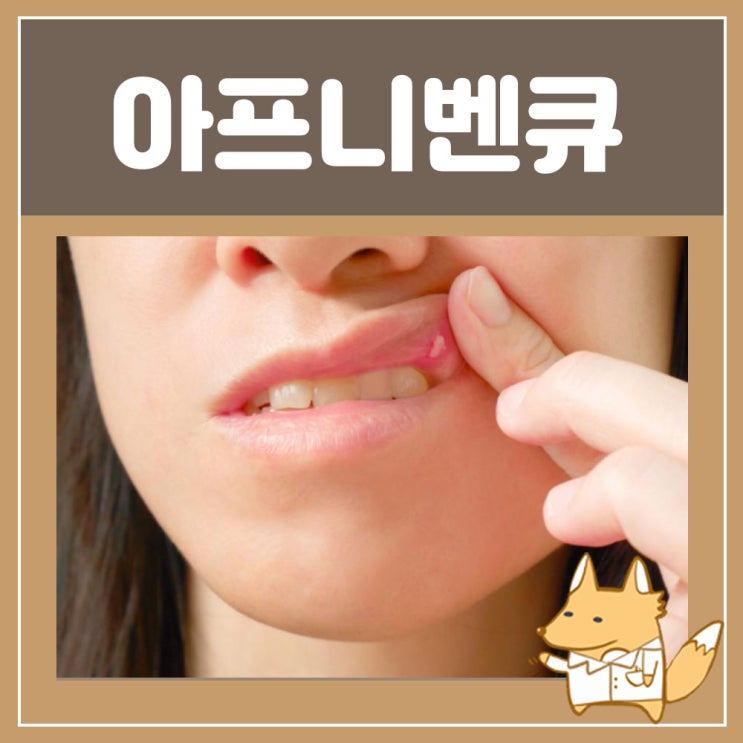  디클로페낙 아프니벤큐 올바른 사용법 : 구내염 치료약 아프니벤큐액