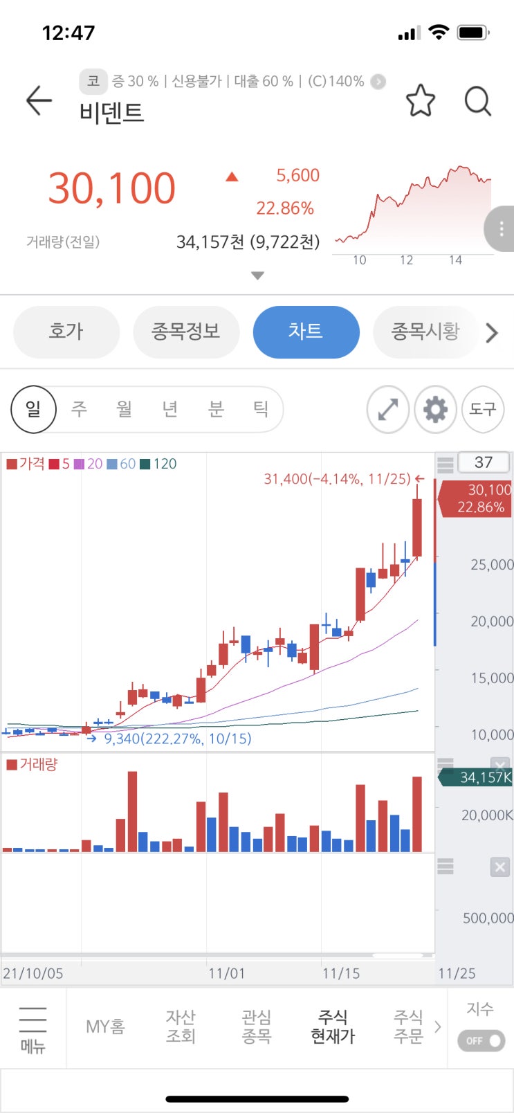  버킷스튜디오, 인바이오젠, 비덴트 삼각관계야 모야 ㅋ