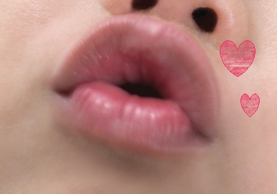  입꼬리 보톡스? 입꼬리 필러? 입술 필러? 오리주둥이?