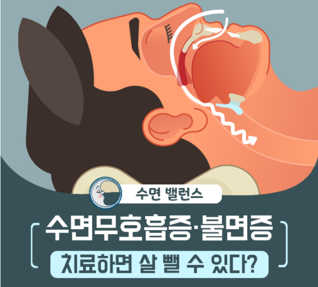  수면무호흡증 불면증 치료하면 살 뺄 수 있다?