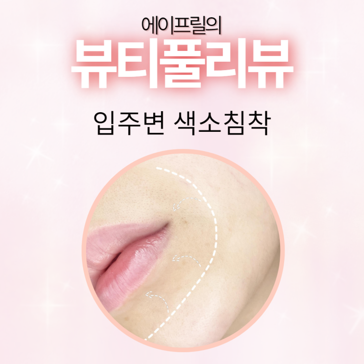 상상도 못한 입주변 색소침착 원인은 바로 이것! 상상도 못한 입주변 색소침착 원인은 바로 이것!