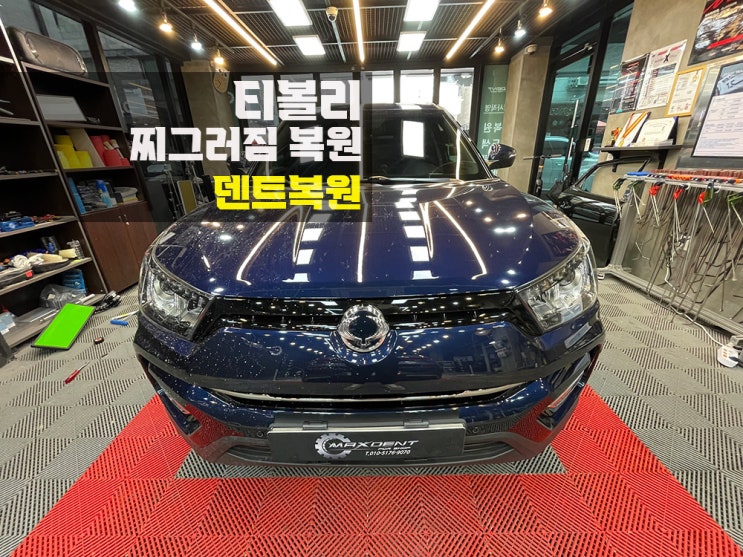  인천 동구 덴트복원 잘하는 곳 MAX DENT