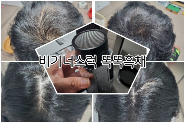 흑채추천 비기너스럭 똑똑흑채 젊은 사람들도 다써요 흑채추천 비기너스럭 똑똑흑채 젊은 사람들도 다써요