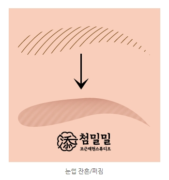  안동 헤어라인 반영구, 붉게 퍼지지 않게 하려면