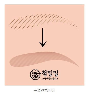 안동 헤어라인 반영구, 붉게 퍼지지 않게 하려면