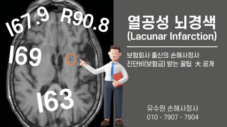  열공성뇌경색(lacunar infarction) 진단비 정말 받을 수 없는 것일까요?