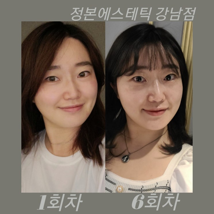  얼굴작아지는 웨딩케어 경락마사지 4~6회차