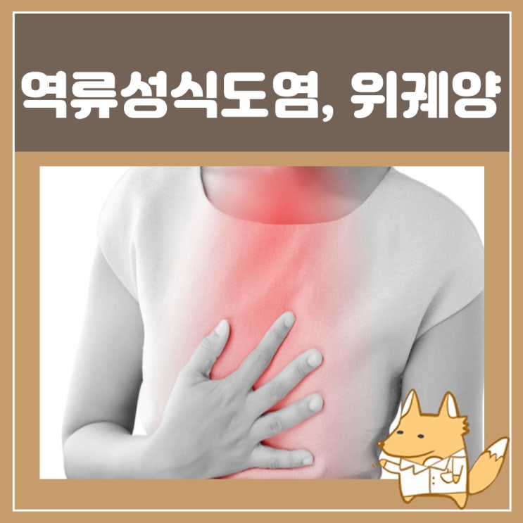  역류성식도염, 위궤양 약 치료 : 케이캡정 50mg 복용법 효능 알아봐요