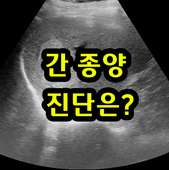  간 종양이 건강검진 복부초음파에서 확인됨. 진단은?