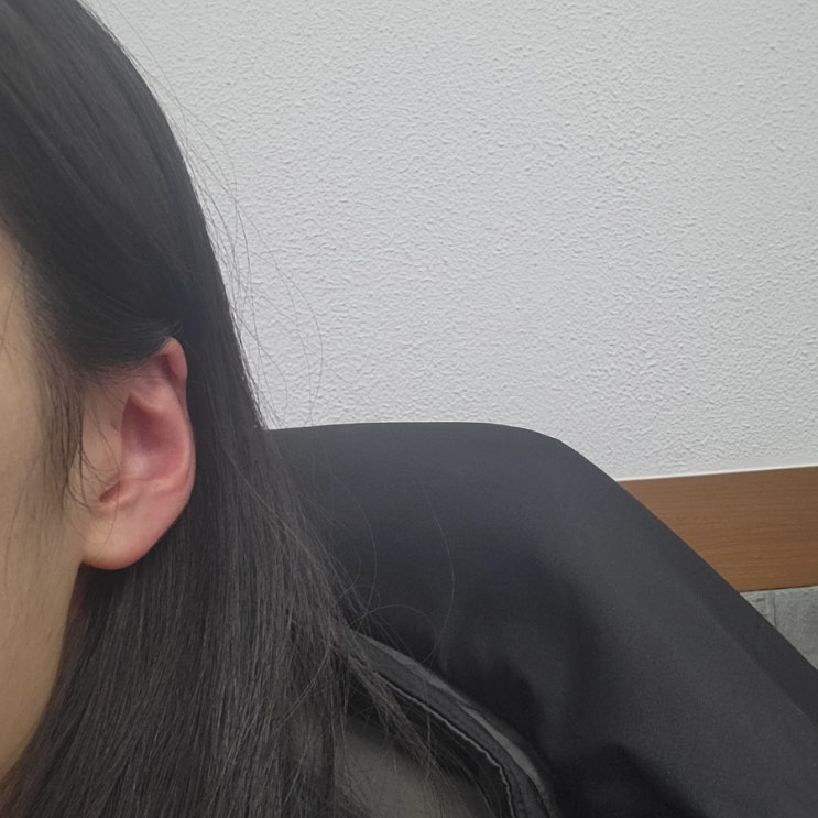  [다발성경화증]텍피데라 복용 중 / 약 부작용??