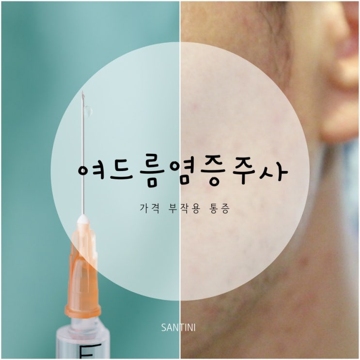 여드름 염증주사 가격 과 부작용 통증 여드름 염증주사 가격 과 부작용 통증