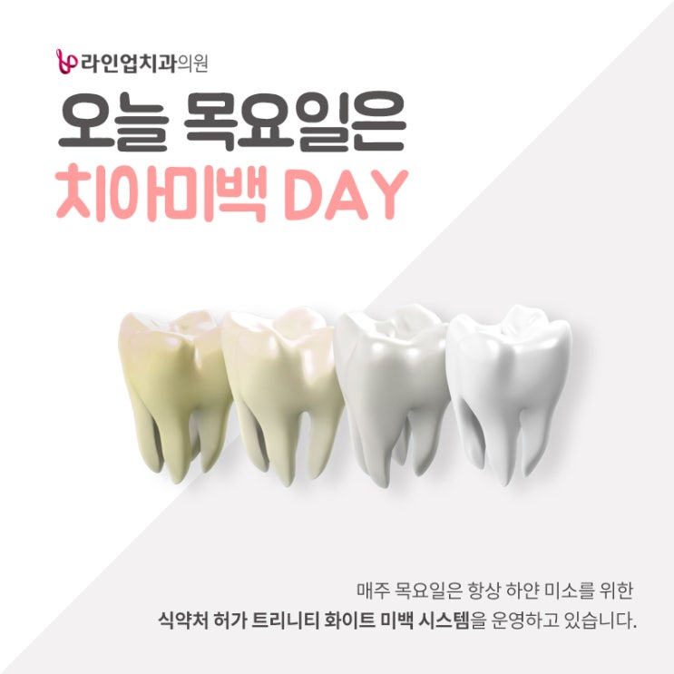  오늘 목요일은 치아미백 DAY !!