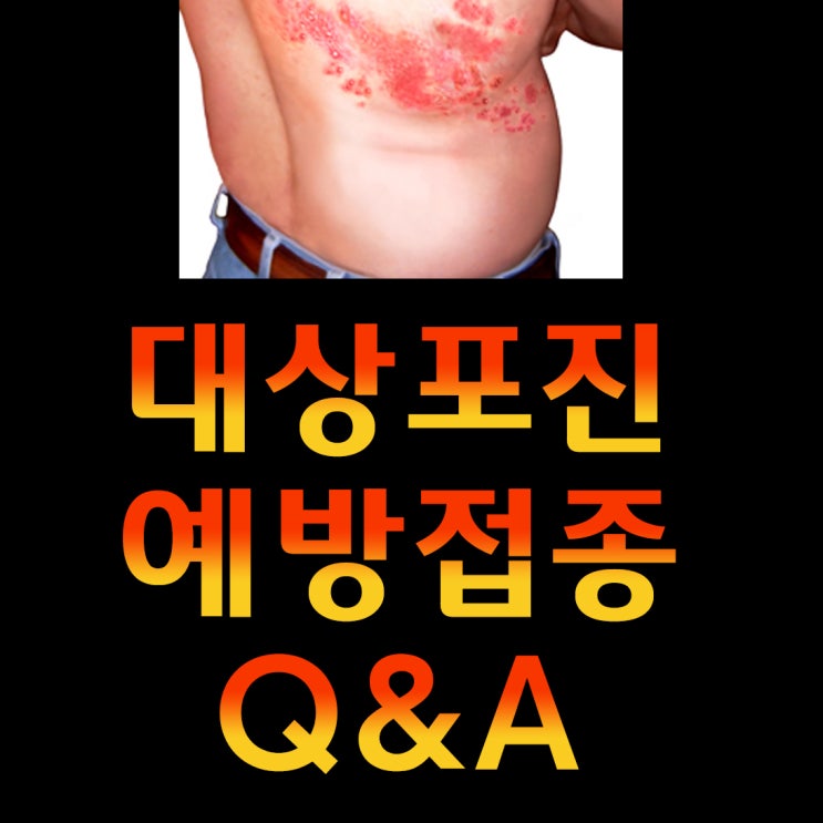  대상포진 예방접종 궁금증 모두 해결 Q&A