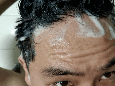  지루성 민감성두피 케어 두피샴푸 탈모샴푸 스칼프 헤어 와사비샴푸