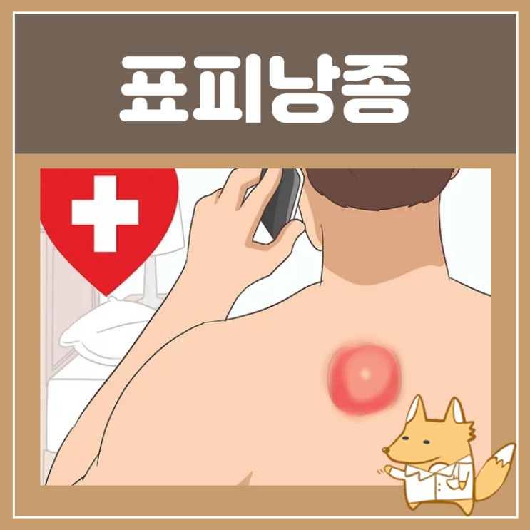  표피낭종 : 목 손목 가슴 팔에 혹, 목뒤에 이마에 혹, 사타구니 혹, 발바닥 뒤통수 혹