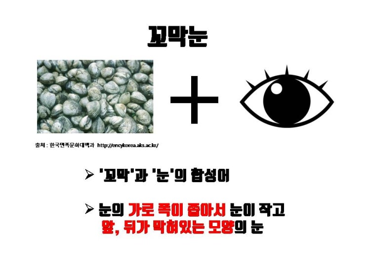  답답해 보이는 꼬막눈 눈수술로 시원한 눈으로 바꿀 수 있어요!!!
