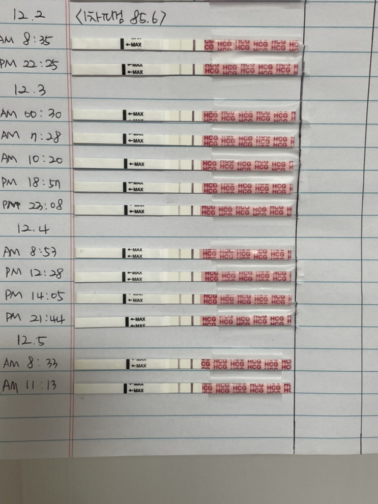 시험관:: 5일배양 11일째 12일째 임테기진하기와 소량 빨간피비침