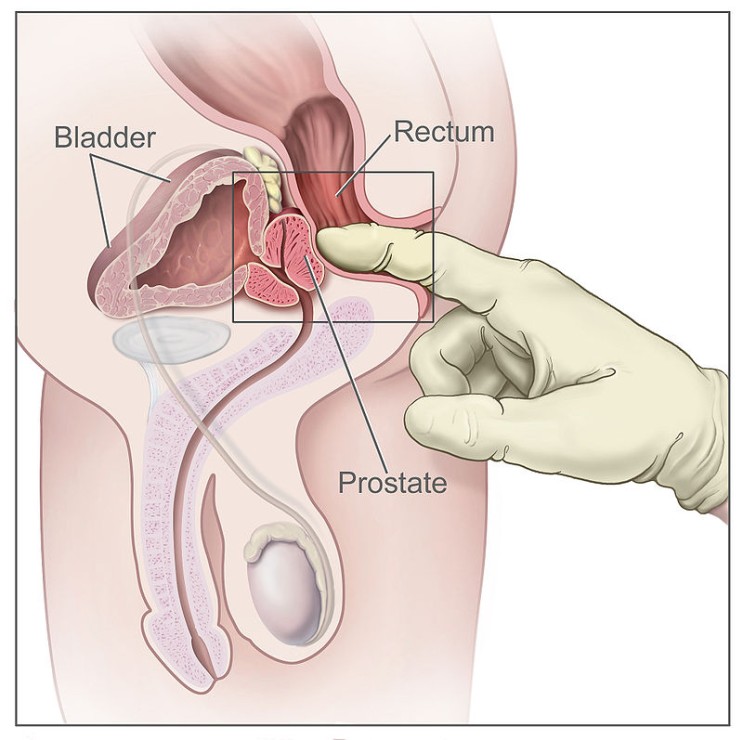 전립선(prostate gland)의 구조