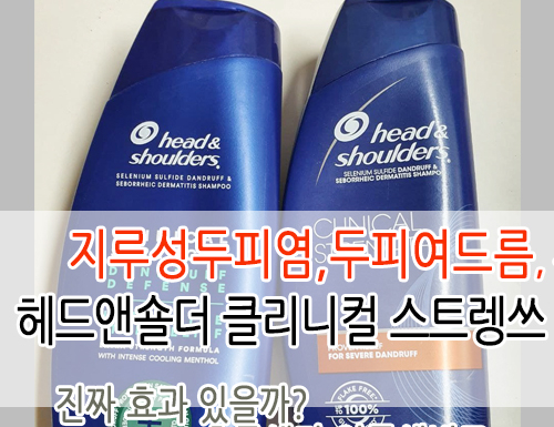  [삶의질상승템]헤드앤숄더 클리니컬스트렝쓰로 두피여드름 효과보고 미쿡 향해 절 백반번