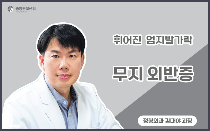 휘어진 엄지발가락 '무지외반증' - 울산정형외과