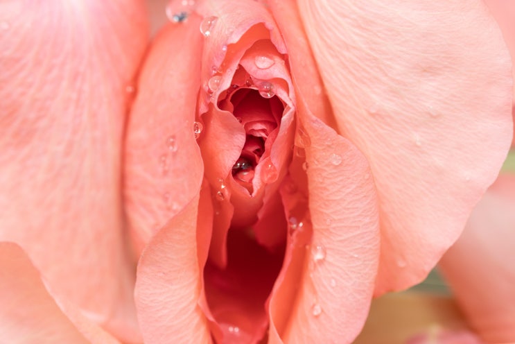  소음순성형, 꼭 필요할까요?수술 없이는 해결할 수 없나요?