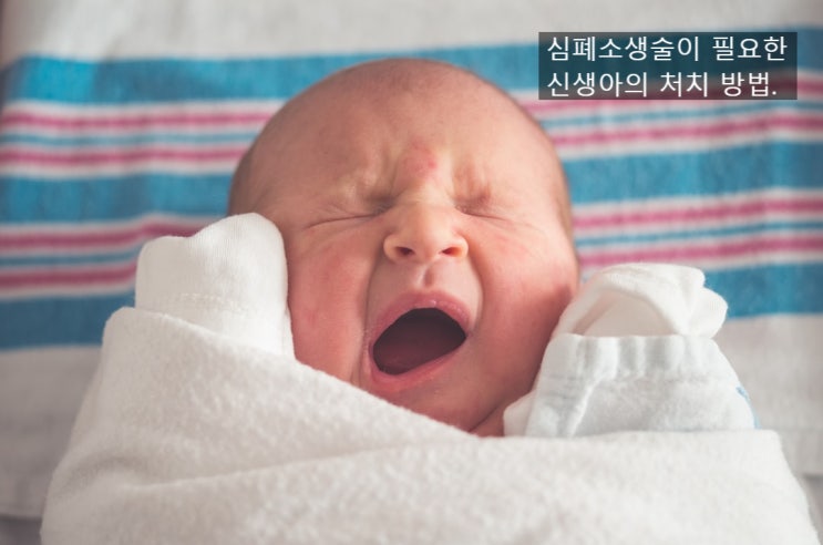  neonatal resuscitation 신생아 소생술-(3) 양압환기의 적절성 평가, 심폐소생술 시행(가슴압박과 에피네프린의 사용)