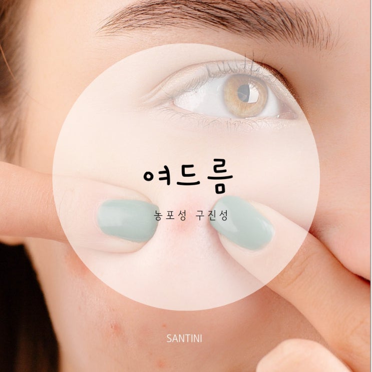 농포성 과 구진성 여드름 관리 농포성 과 구진성 여드름 관리