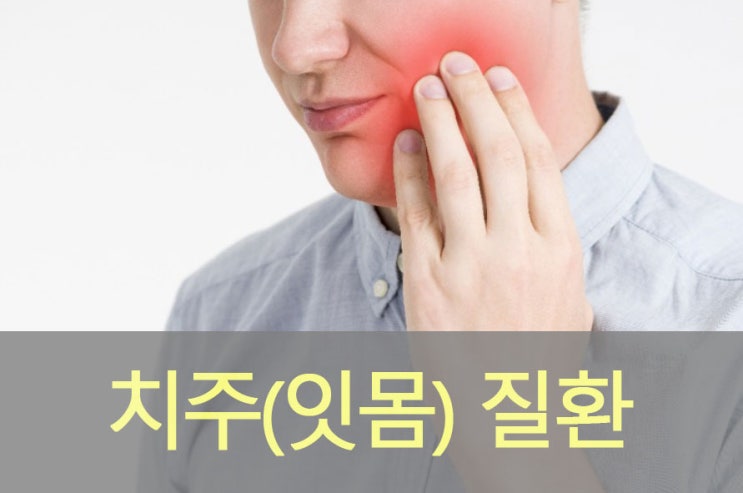 치주 질환(잇몸질환) 원인과 증상, 좋은 음식, 영양제