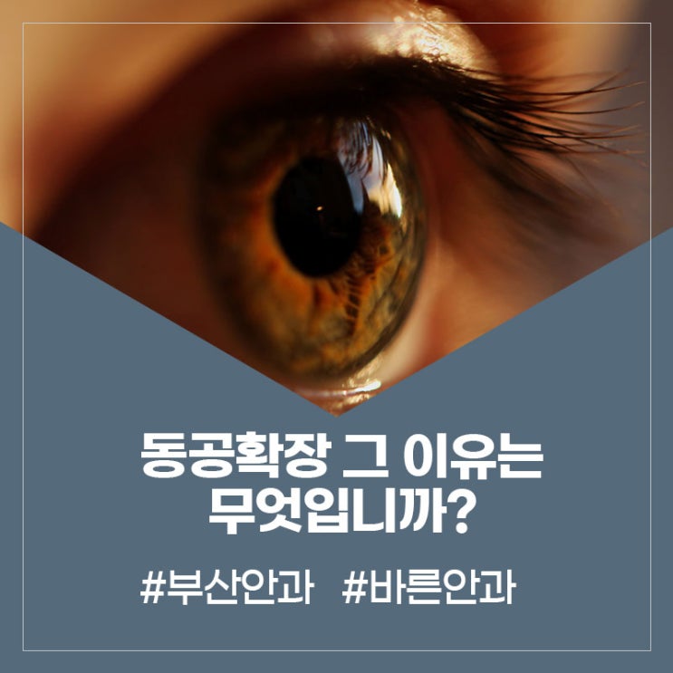  동공확장 그 이유는 무엇입니까? - 부산안과