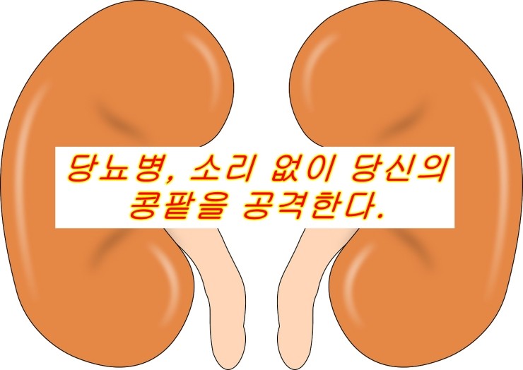  당뇨병, 소리 없이 당신의 콩팥을 공격한다.