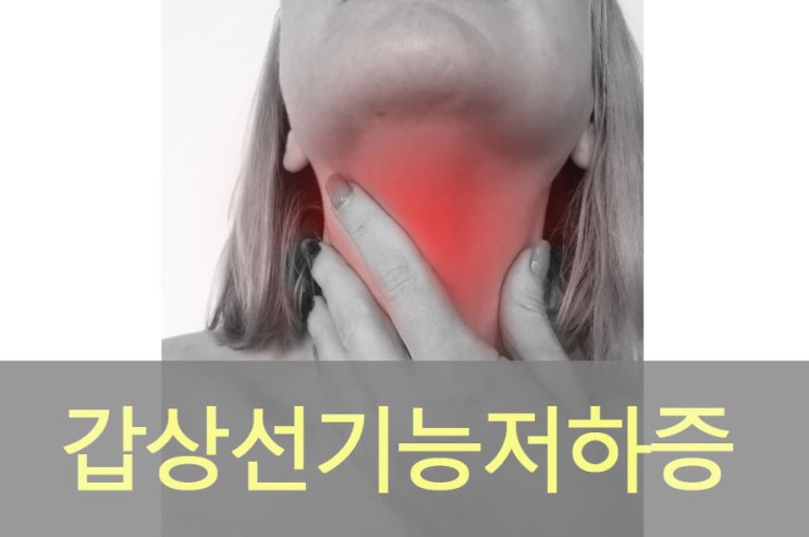  갑상선 기능 저하증 원인과 증상, 예방, 좋은 음식