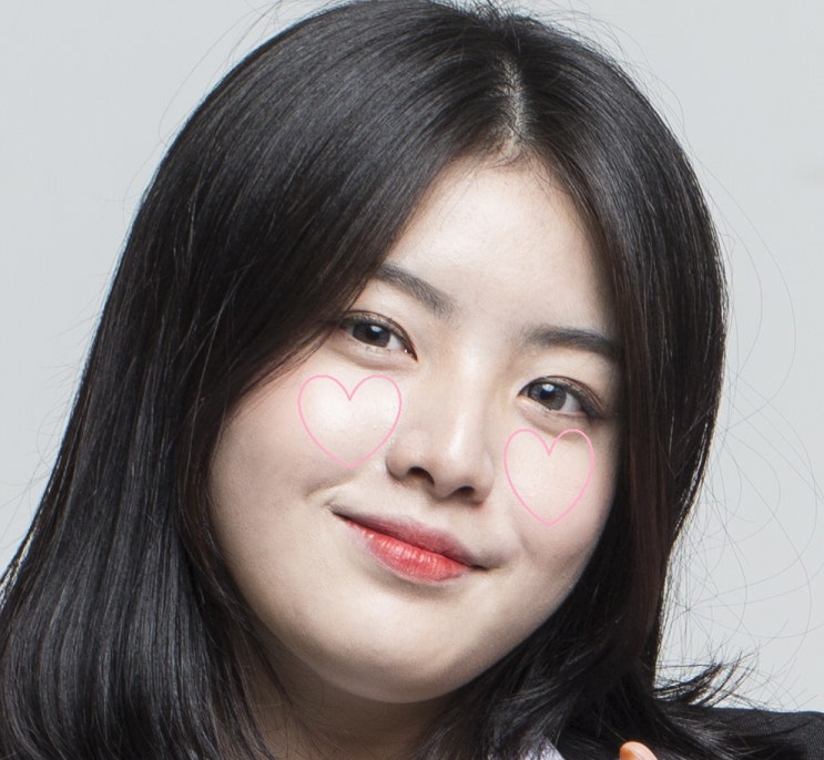  앞광대 필러, 앞볼 필러, 애플존 필러, 동안 필러, 베이비 필러... 헉헉;;; 다 같은 목적의 필러 이름입니다!