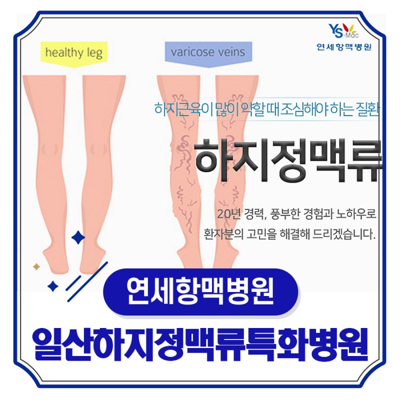 일산 하지정맥류 증상 체크 하지정맥류 자가진단법