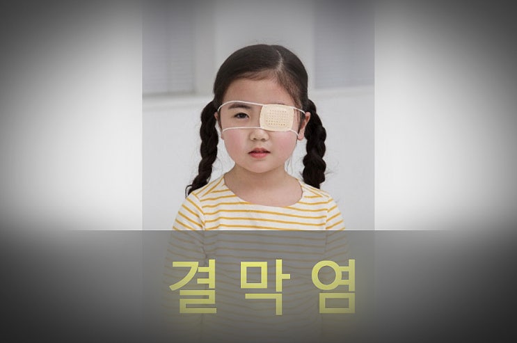  결막염 원인과 증상, 예방, 좋은 음식