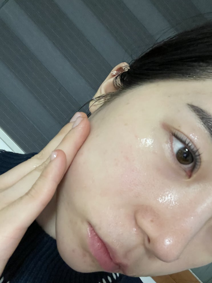  늙기 전에 미리 피부탄력관리 하자 쫀쫀밀착되는 체르엠 콜라겐앰플