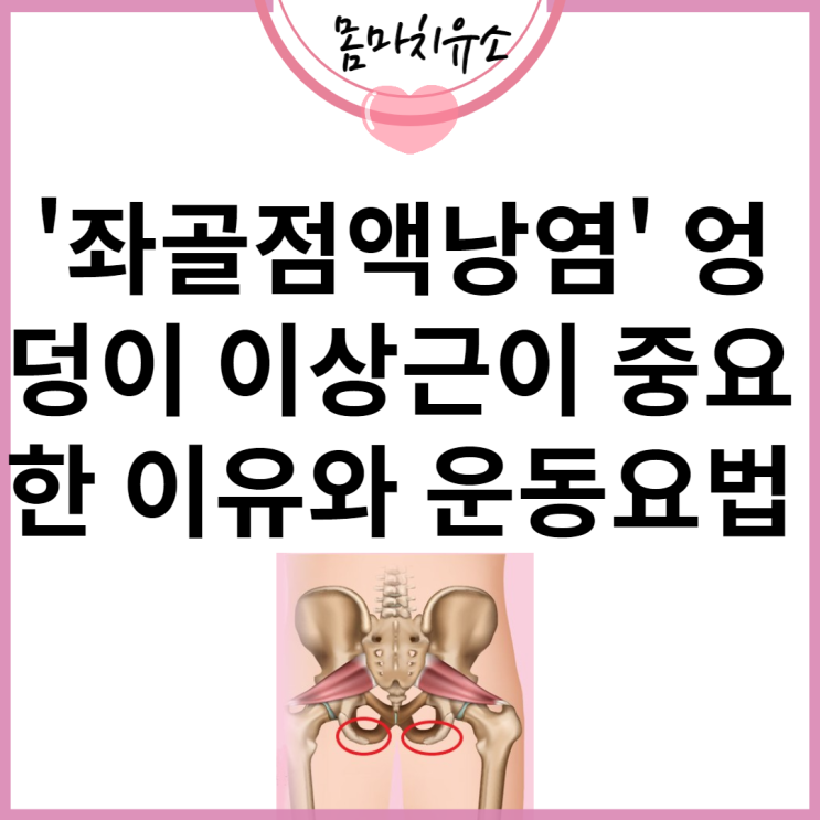 '좌골점액낭염 원인' 엉덩이 이상근이 중요한 이유와 운동요법