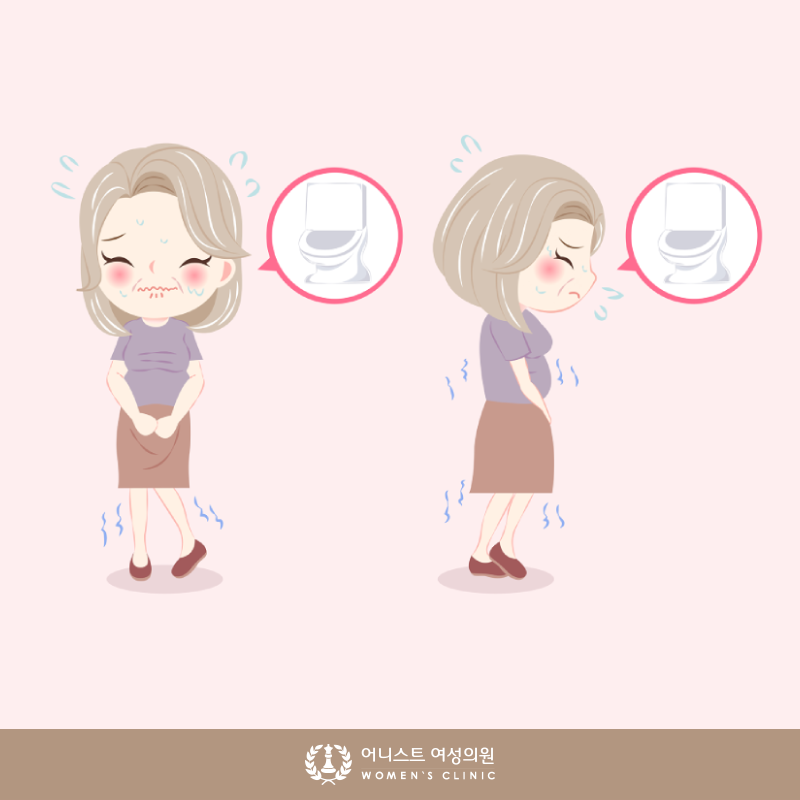 요실금 케겔 운동/음식/생활 습관: 요실금 예방에 대한 완전한 요약 5