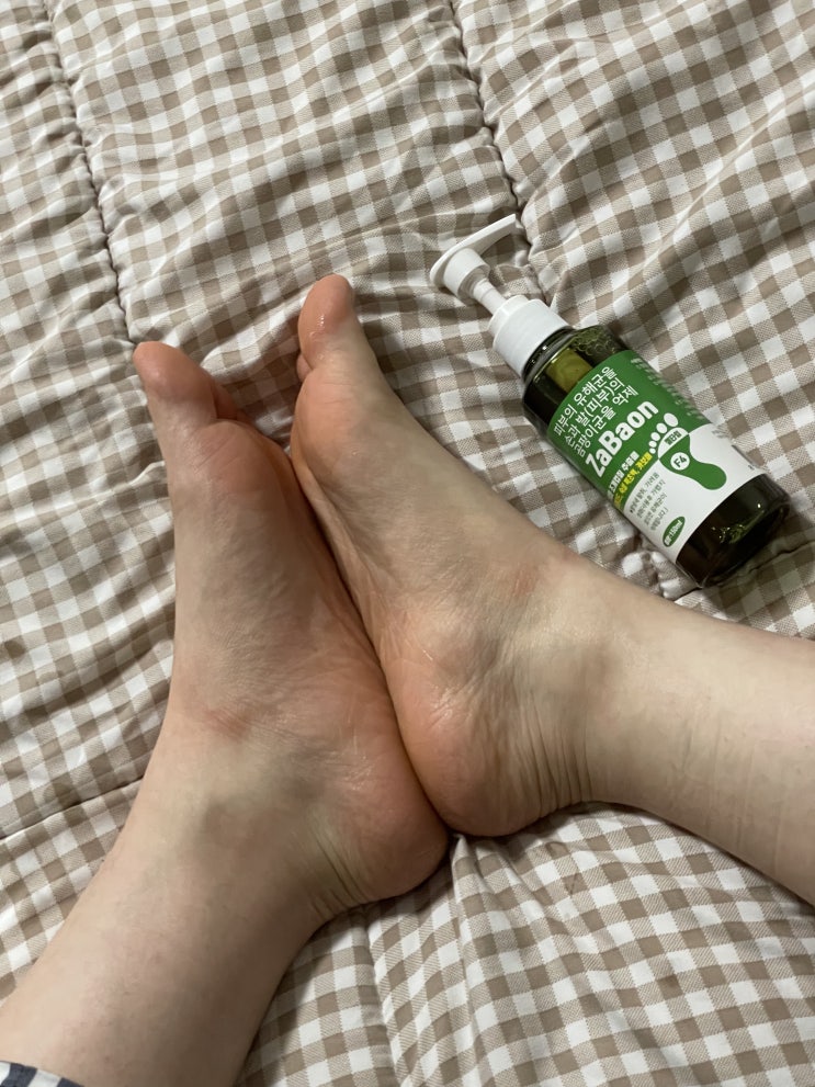  발무좀 발습진 있는분들 주목하세요! 광장메디칼 자바온F4 사용후기