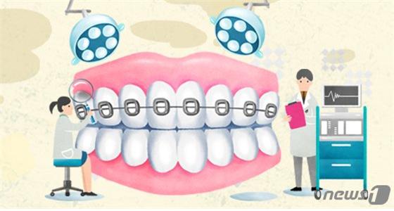 임플란트 심기만 했는데… 치조골 수술로 보험금 타면 사기죄 임플란트 심기만 했는데… 치조골 수술로 보험금 타면 사기죄