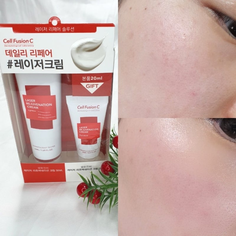 셀퓨전씨 재생크림 피부 속상할때는 레이저크림