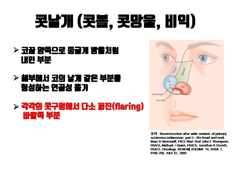  콧날개가 비주보다 처져 보여 고민이라면 콧날개 올리기를!!!