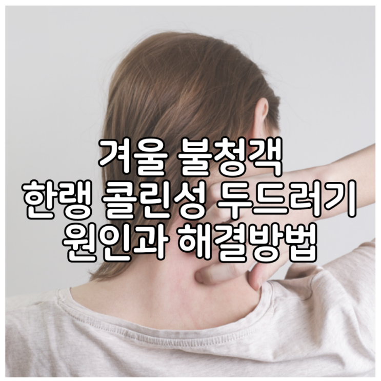  겨울 불청객, 한랭 콜린성 두드러기 원인과 치료방법
