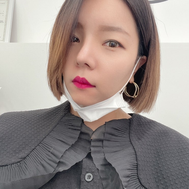  내돈내산 복코재수술  수술73일차 후기!(2달하고 2주지났어용)