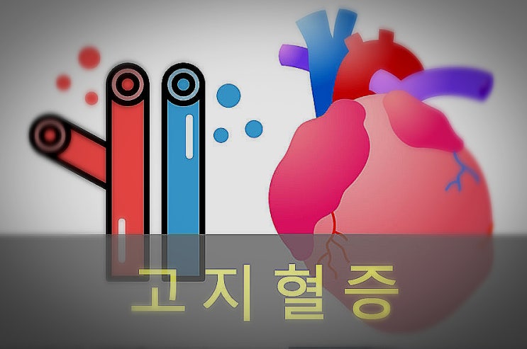  고지혈증 원인과 증상, 예방, 좋은 음식