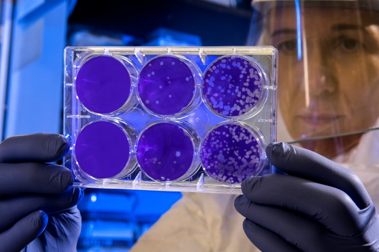 세포검사기사 (Cytotechnologists) 세포검사기사 (Cytotechnologists)