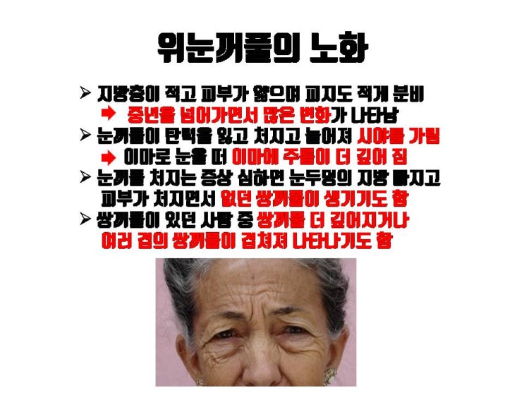  위눈꺼풀 피부가 늘어졌을 때 인상이 강해지는 게 걱정이 된다면 눈썹밑거상술을!!!