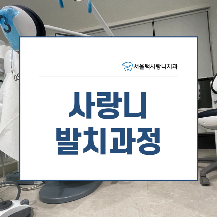  사랑니전문 치과에서 알려주는 사랑니발치과정